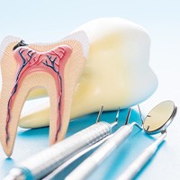 Large model of damaged tooth next to dental instruments