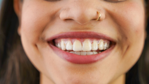 Close up of woman smiling while wearing Invisalign