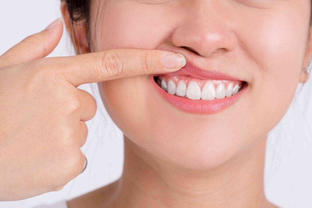 Woman touching her gums